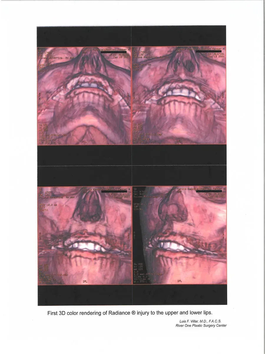 botox near me