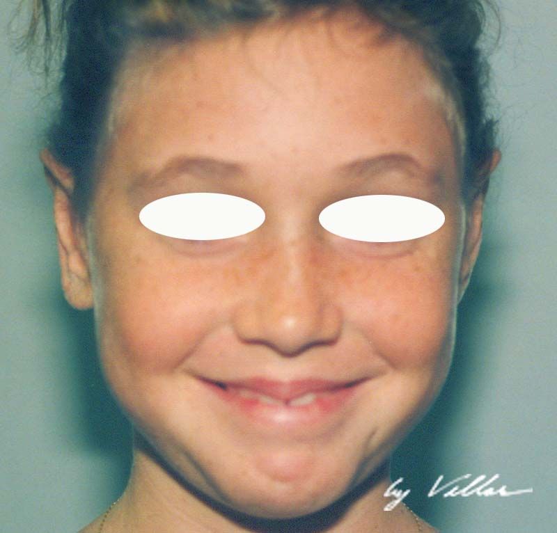 Facial Surgery