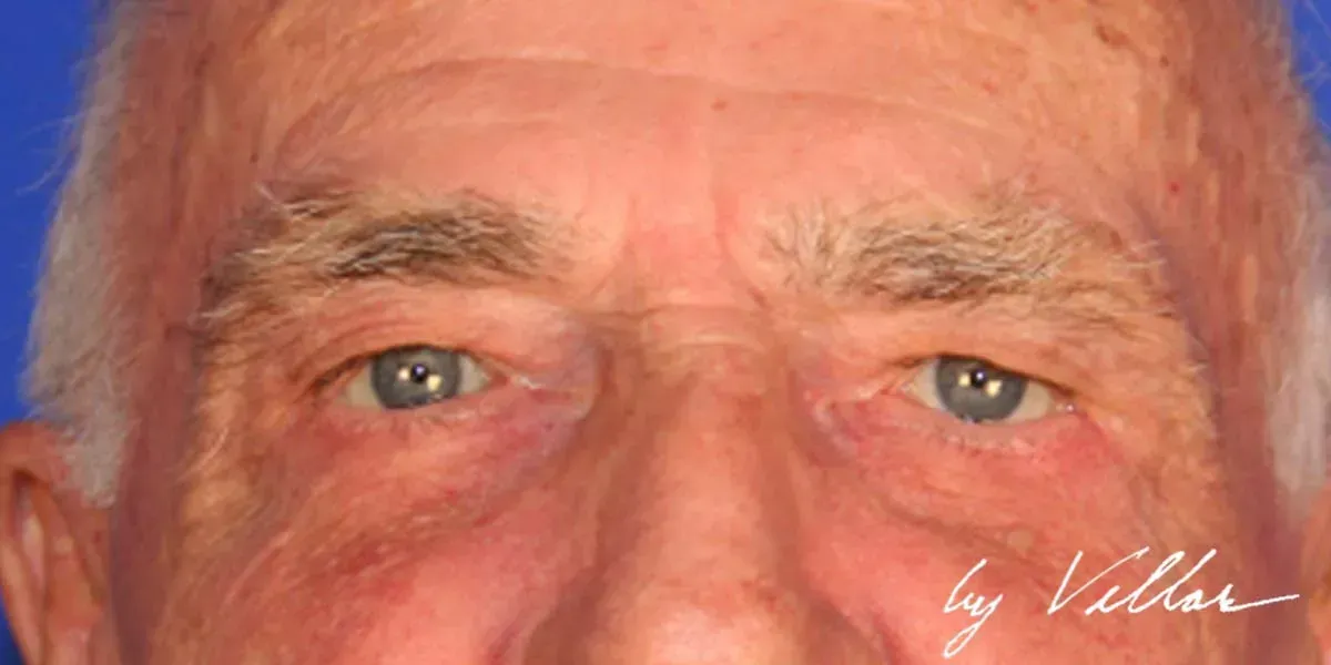 Facial Surgery