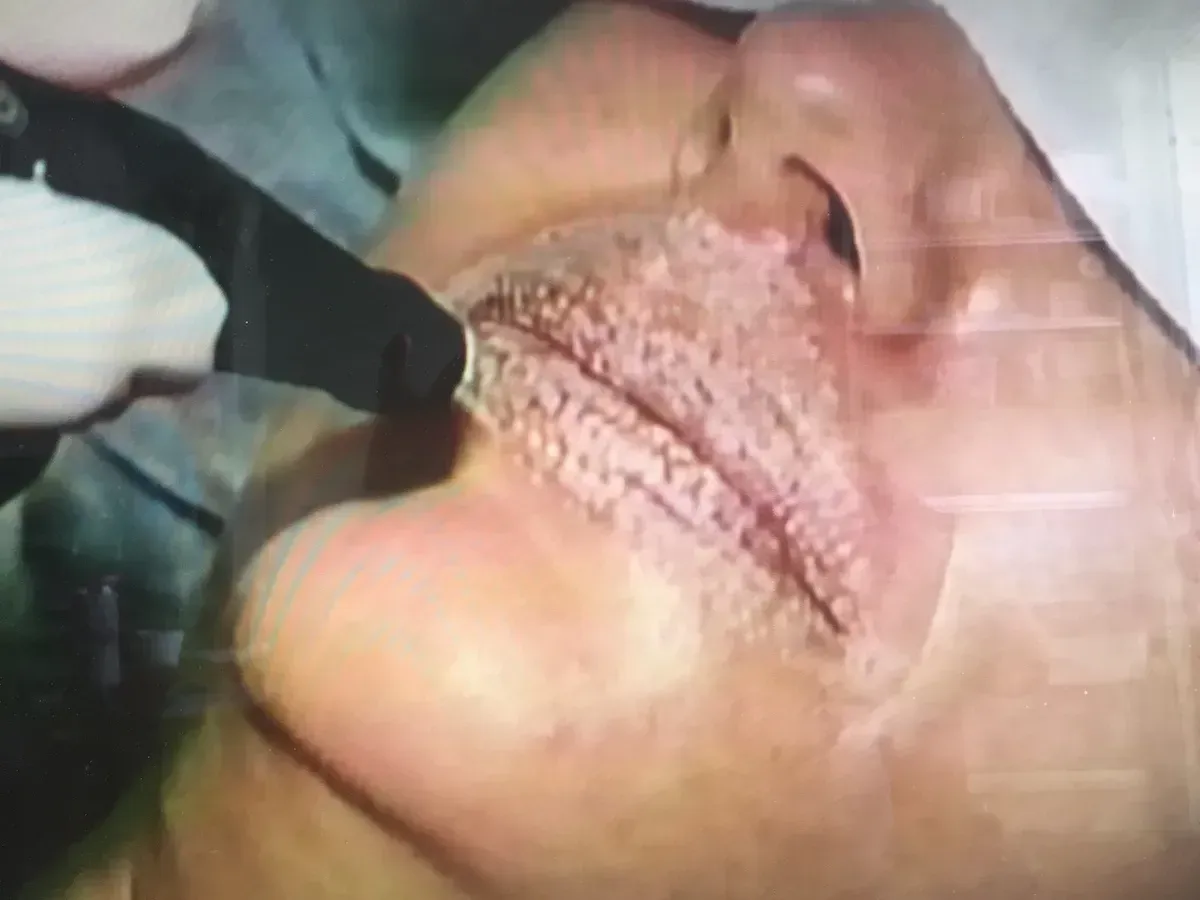Facial Surgery