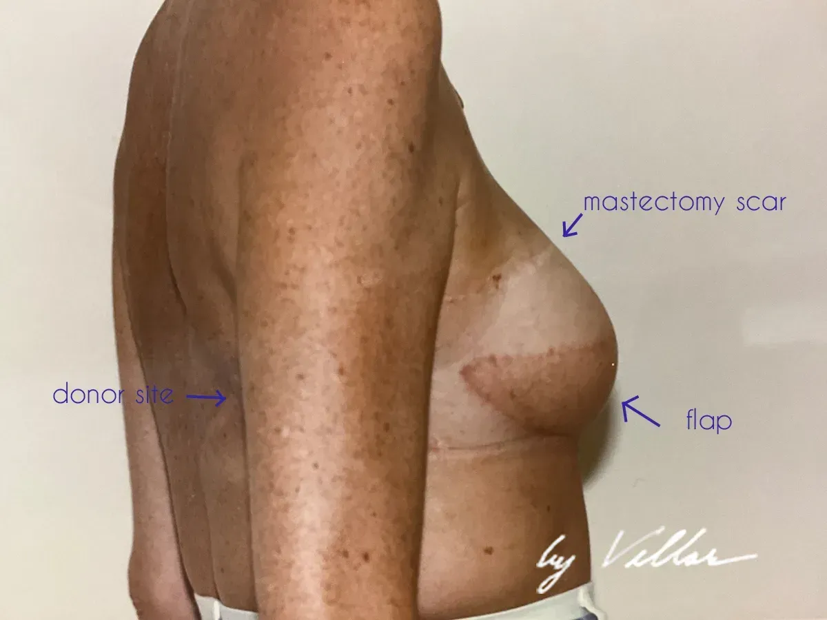 Reconstructive Surgery