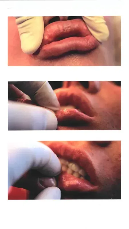 botox near me