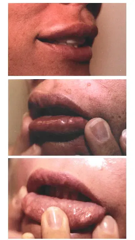 botox near me
