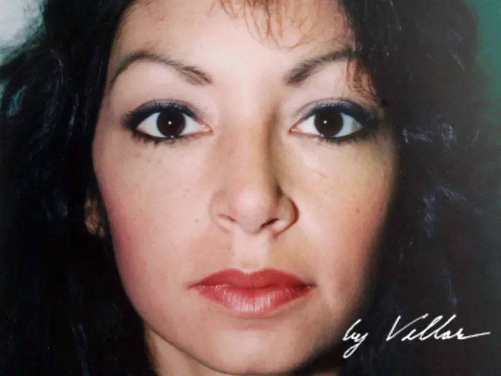 Facial Surgery