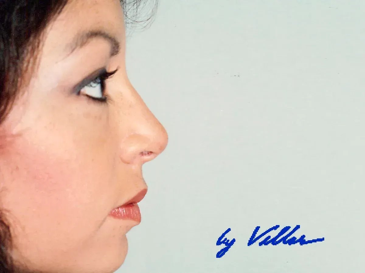 Plastic Surgery