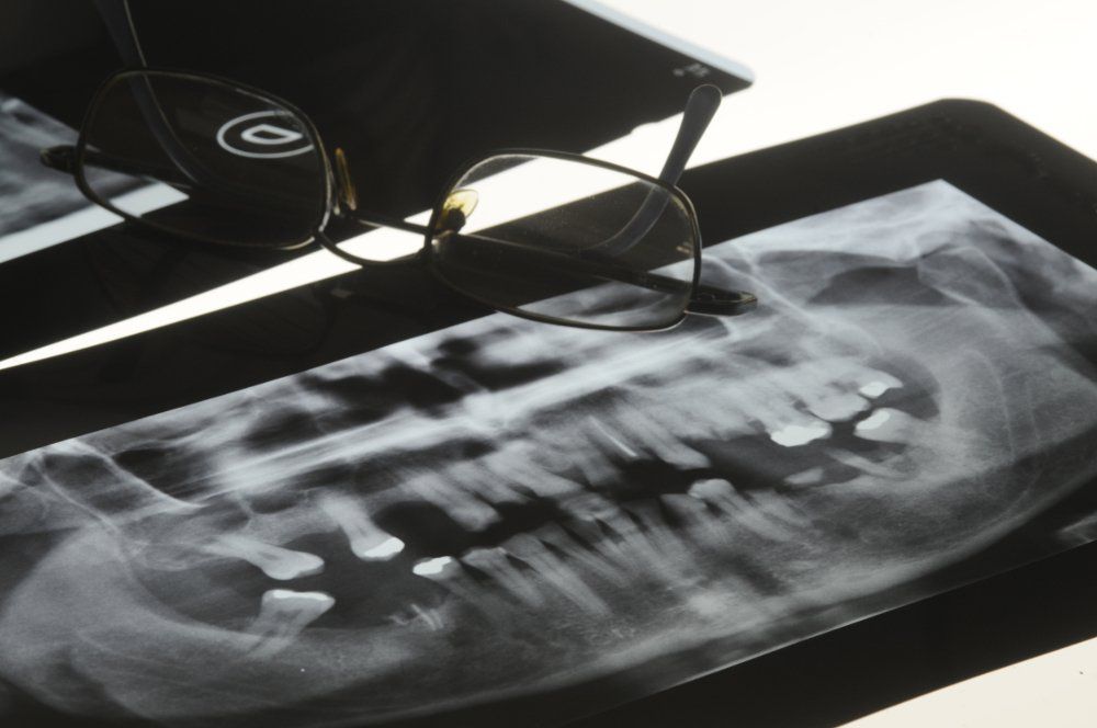 Radiografia