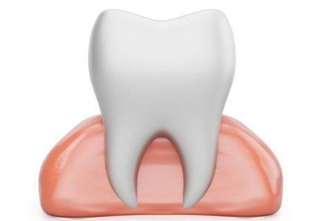 Dente