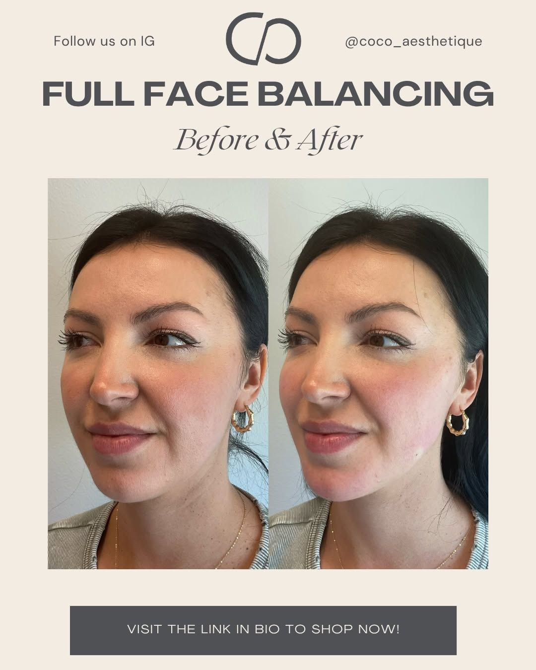 Before & after of a woman's face. The 