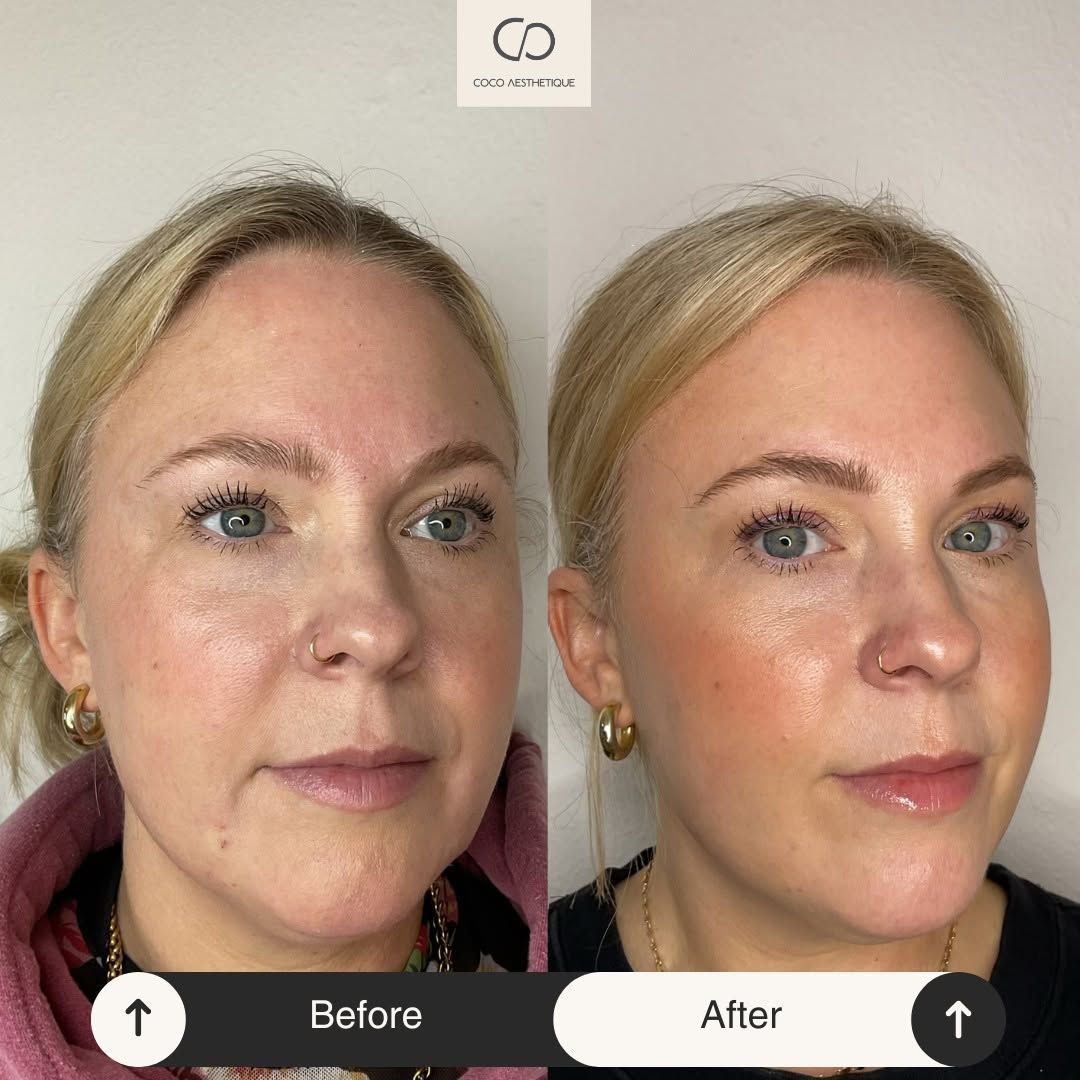 Before and after facial treatment comparison. Woman's face shows improved skin tone and texture, enhanced makeup.