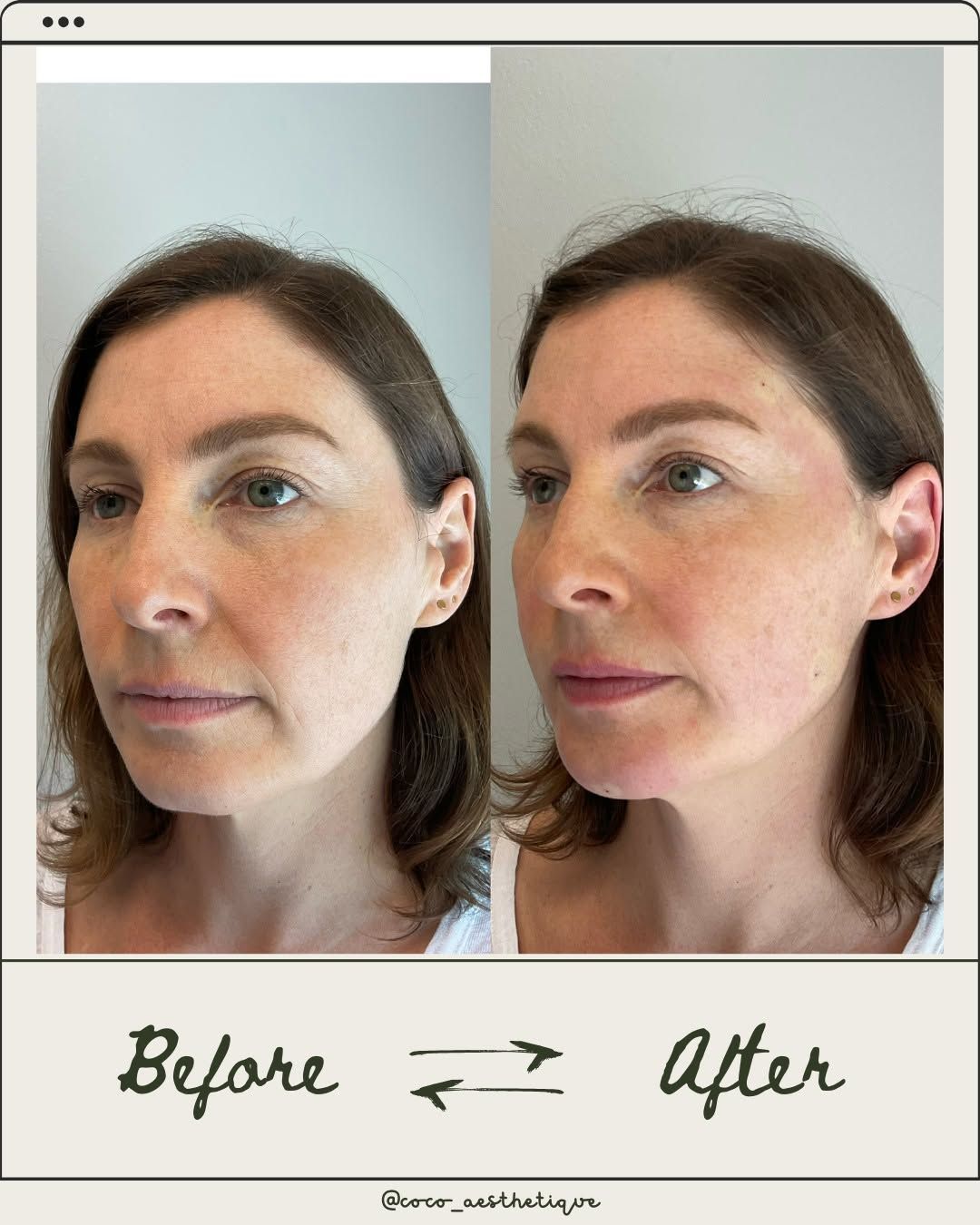 Side-by-side comparison of a woman's face, labeled 