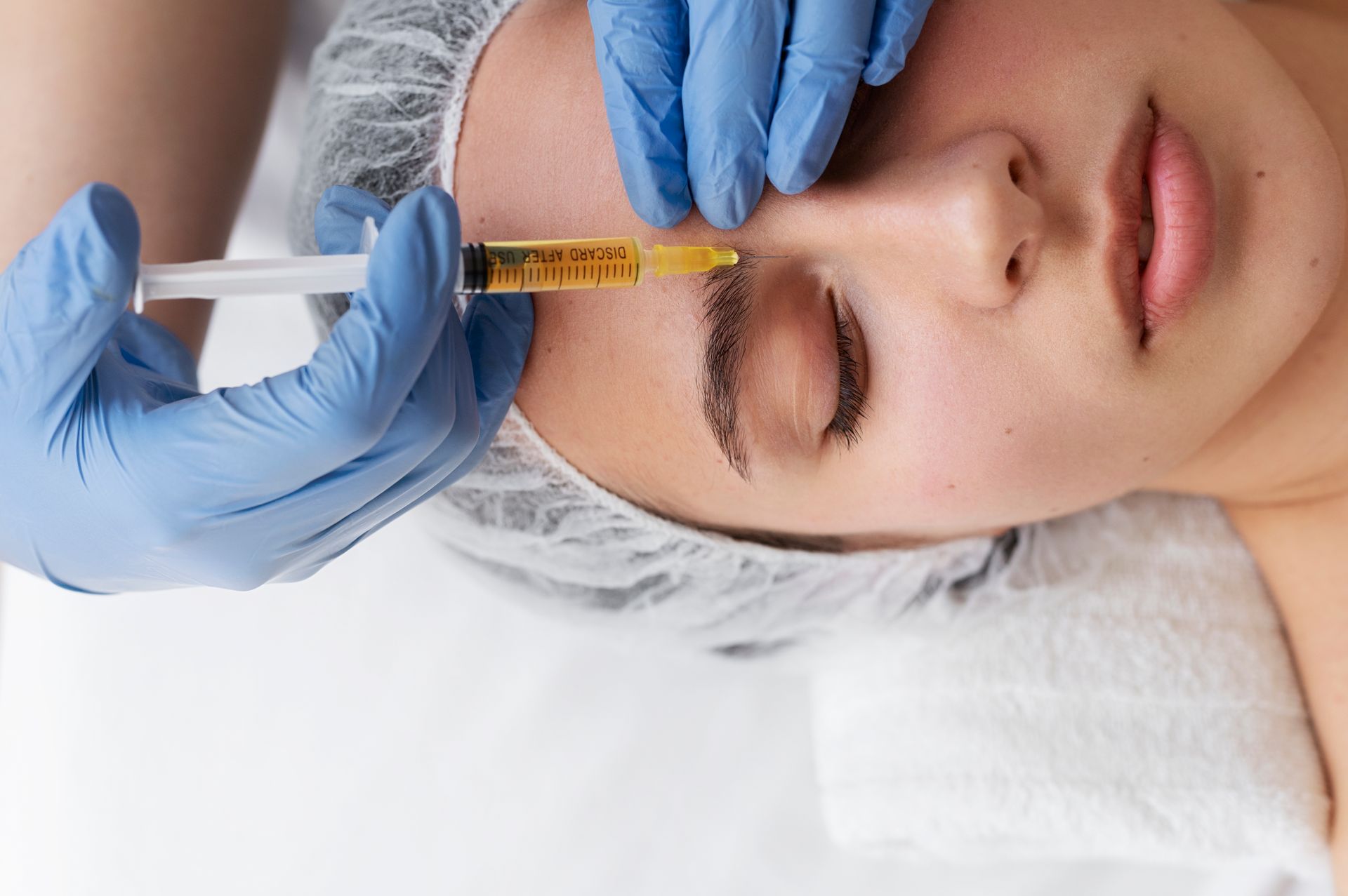 Gloved hands inject a woman’s forehead with a syringe during a cosmetic procedure.