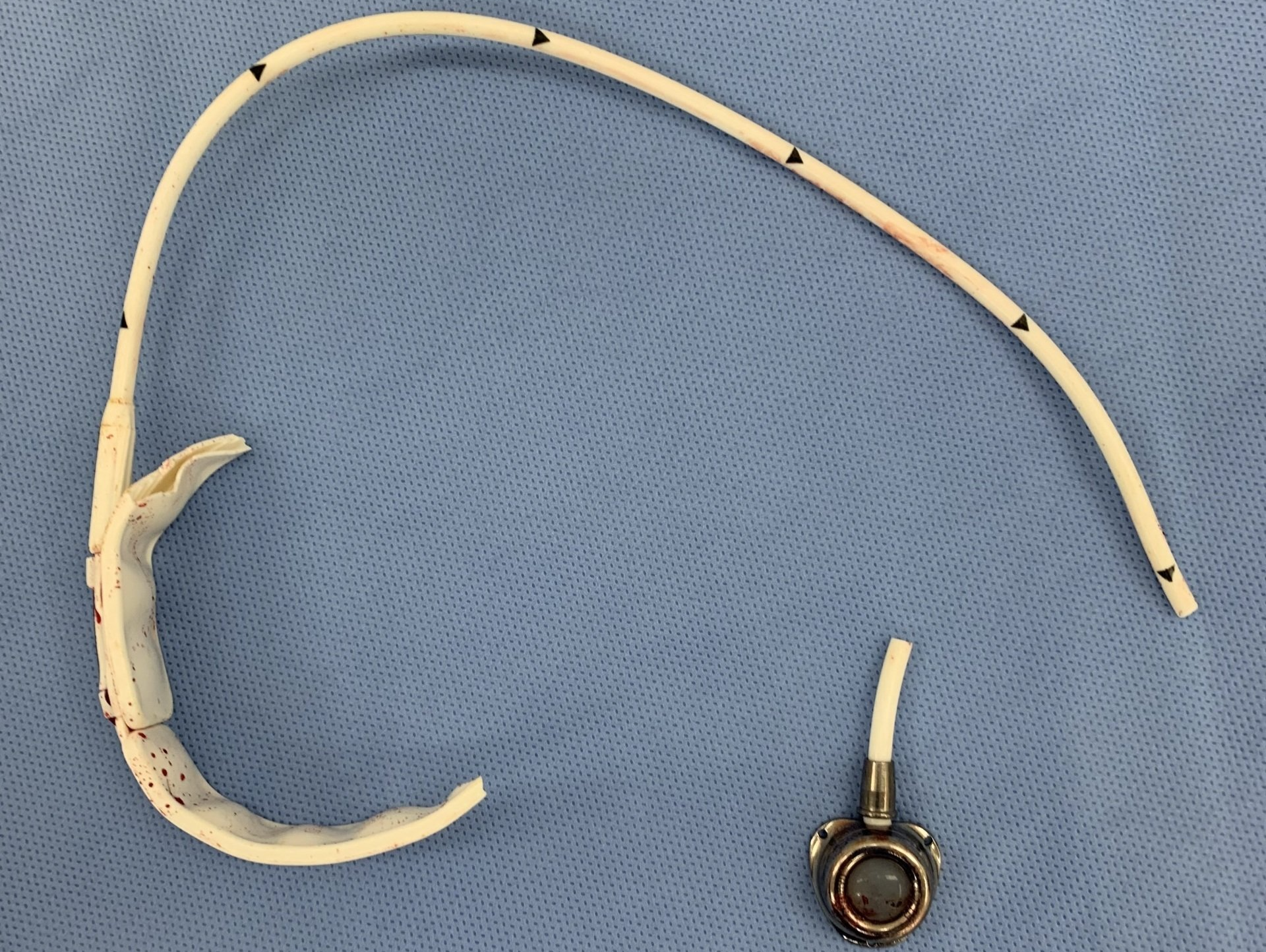 Gastric band removal