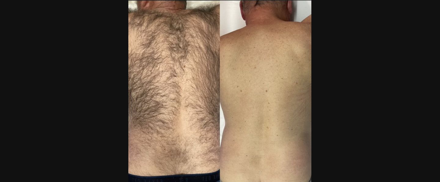 before and after 1