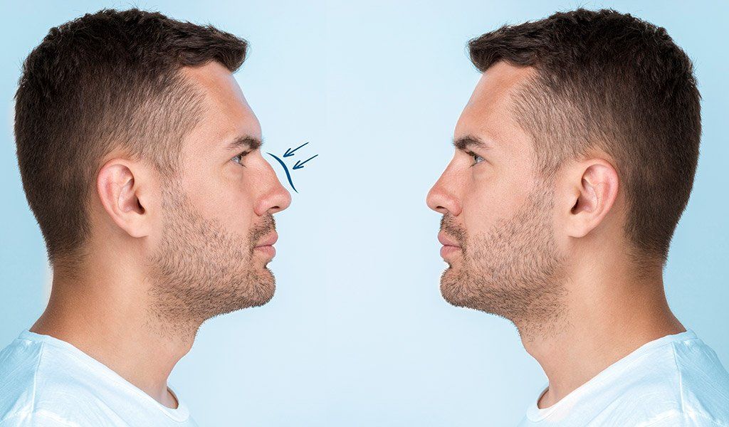 cirugía estética facial en Mollet del Vallès