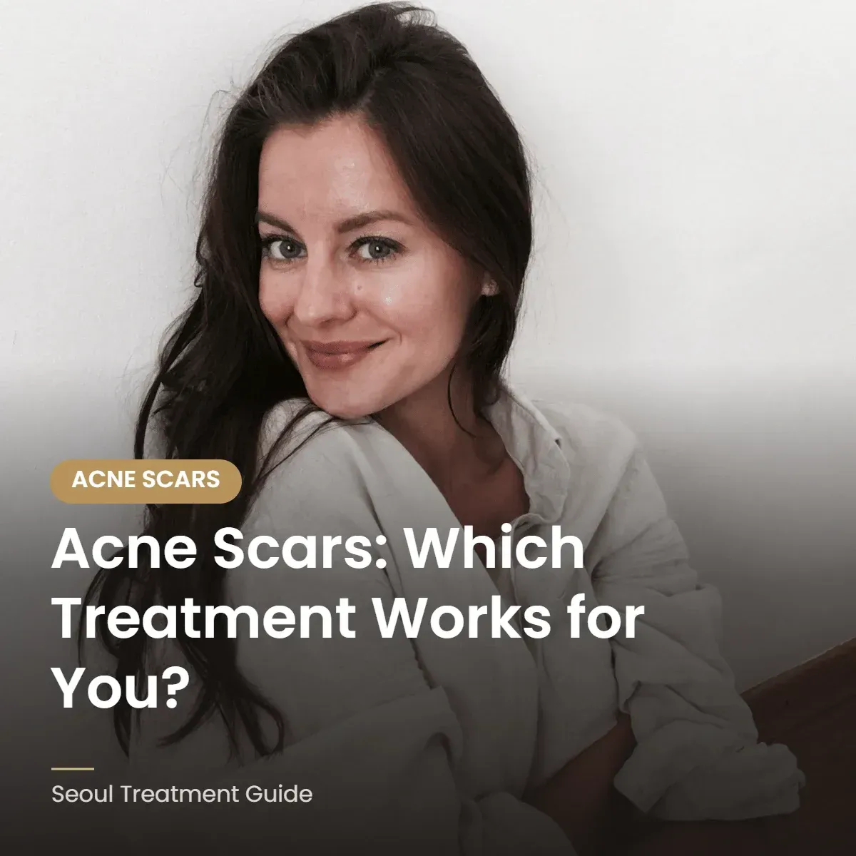 Acne scar treatment options by scar type