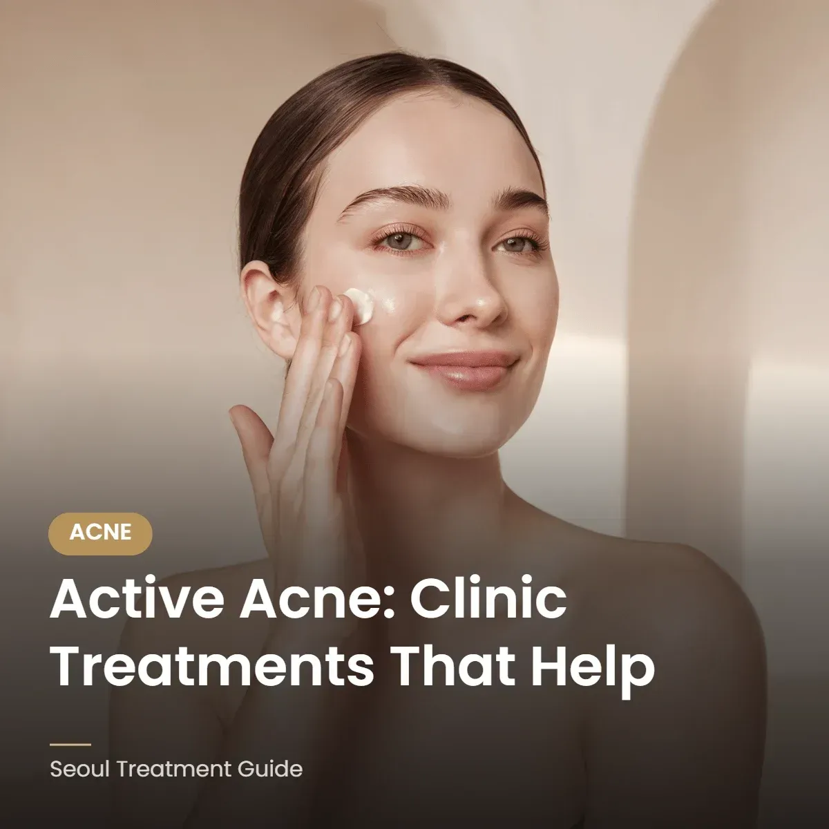 Clinic treatments for active acne