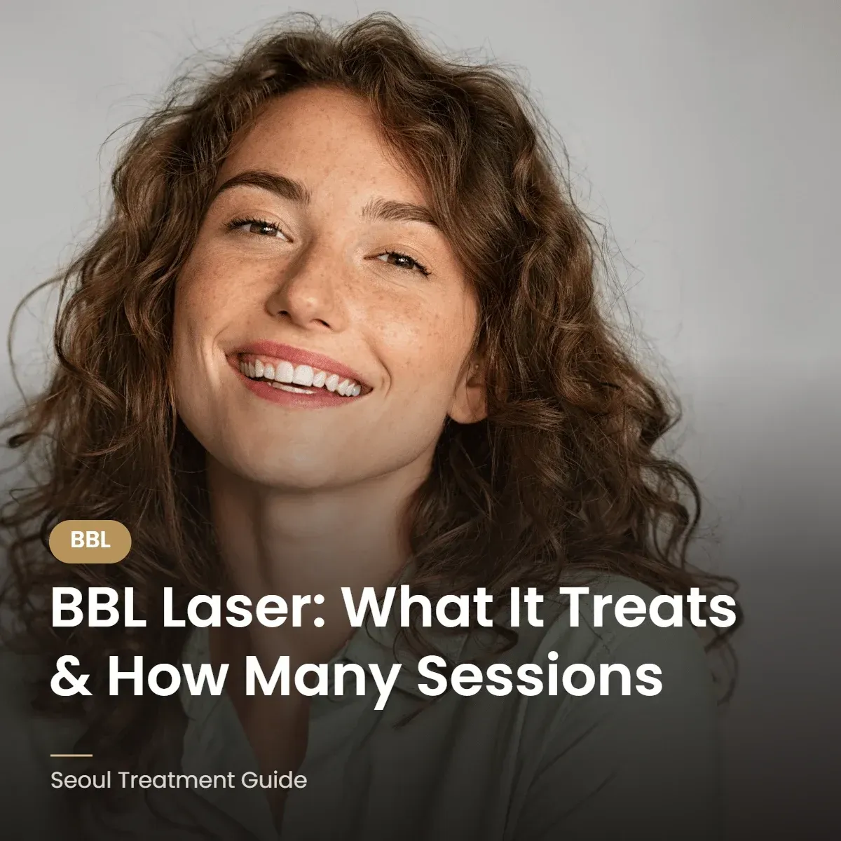 BBL laser for pigmentation and redness