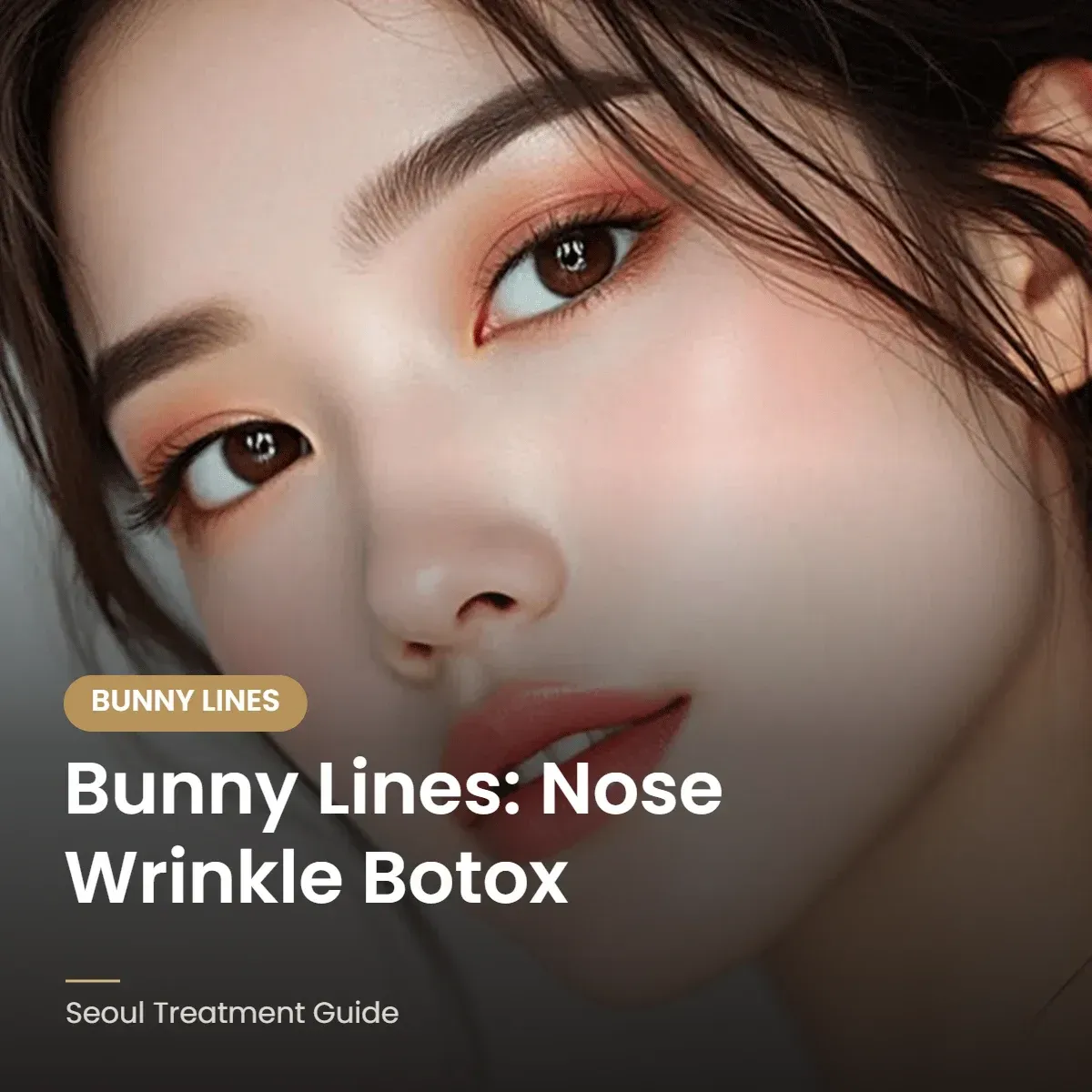 Botox for bunny lines on the nose