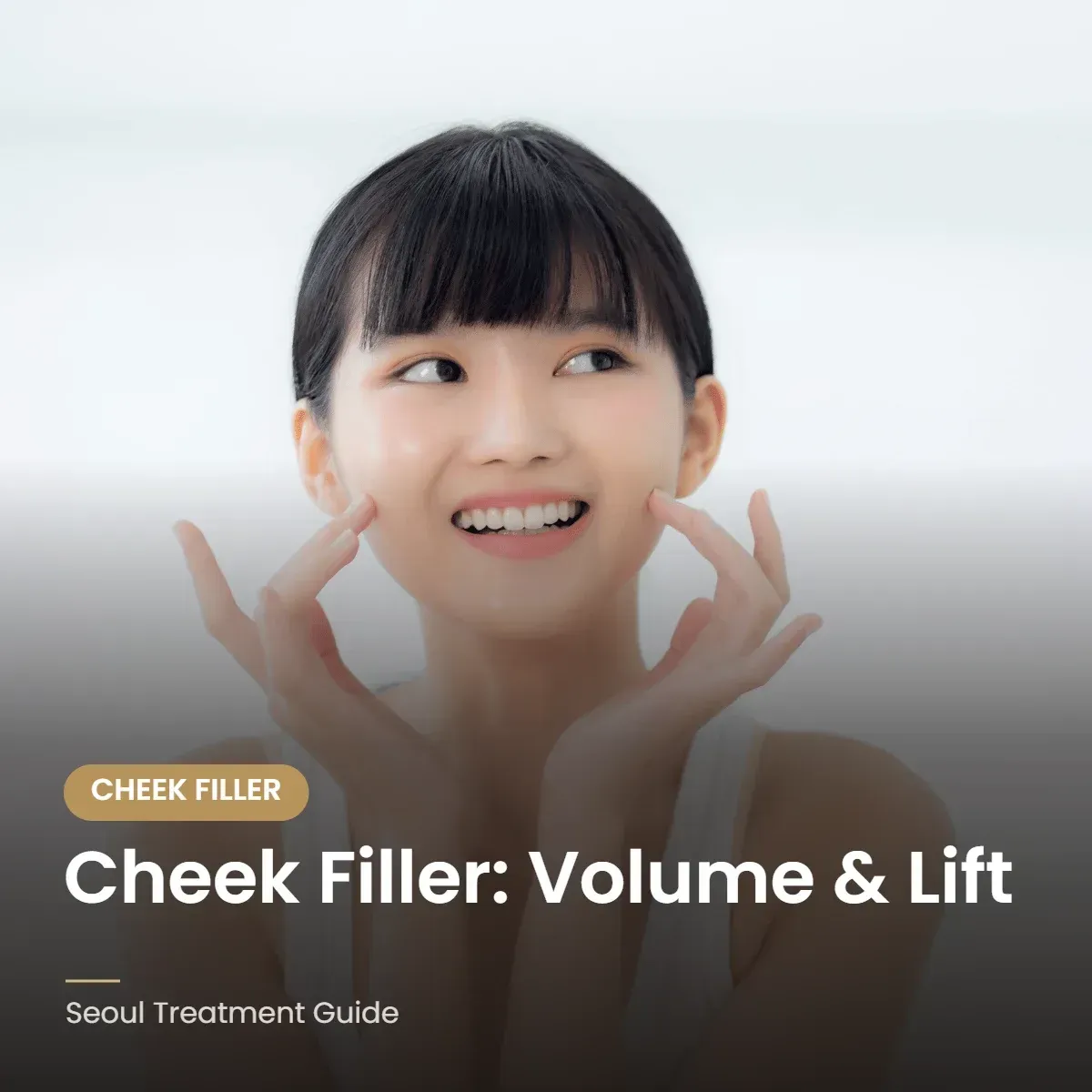 Cheek filler for midface volume