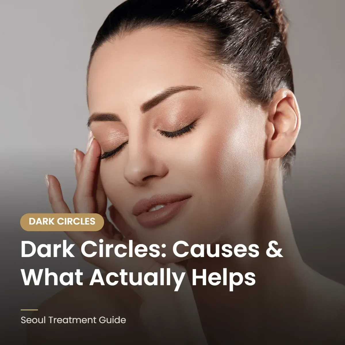 Dark circles causes and treatments