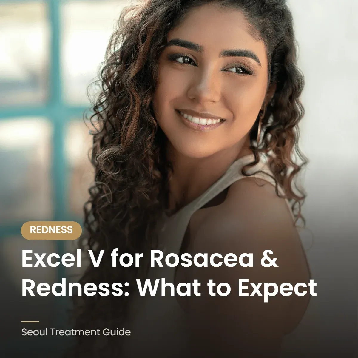 Excel V laser for rosacea and redness