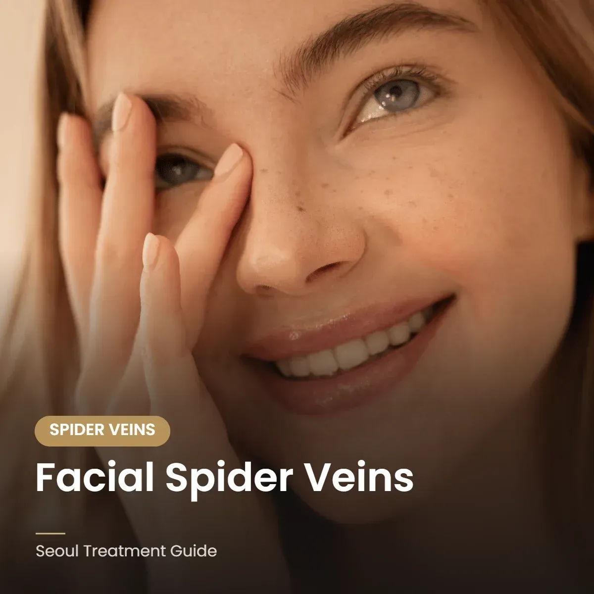 Facial spider vein laser treatment