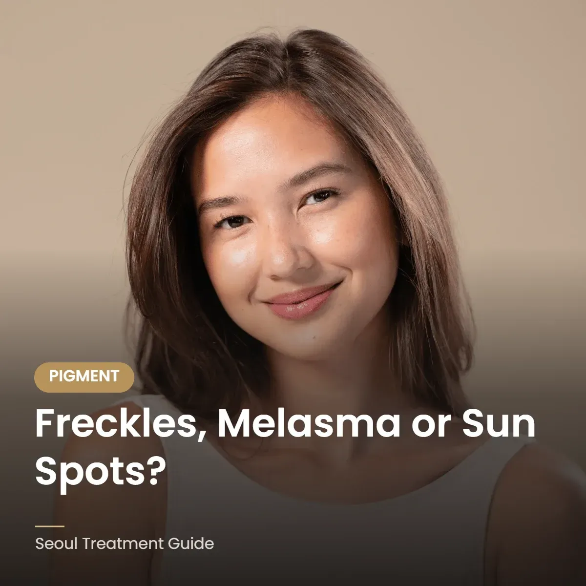 Freckles, melasma and sun spots compared