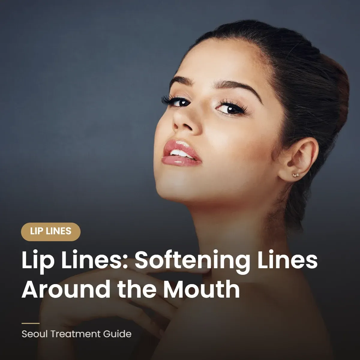 Treatment for lip lines around the mouth