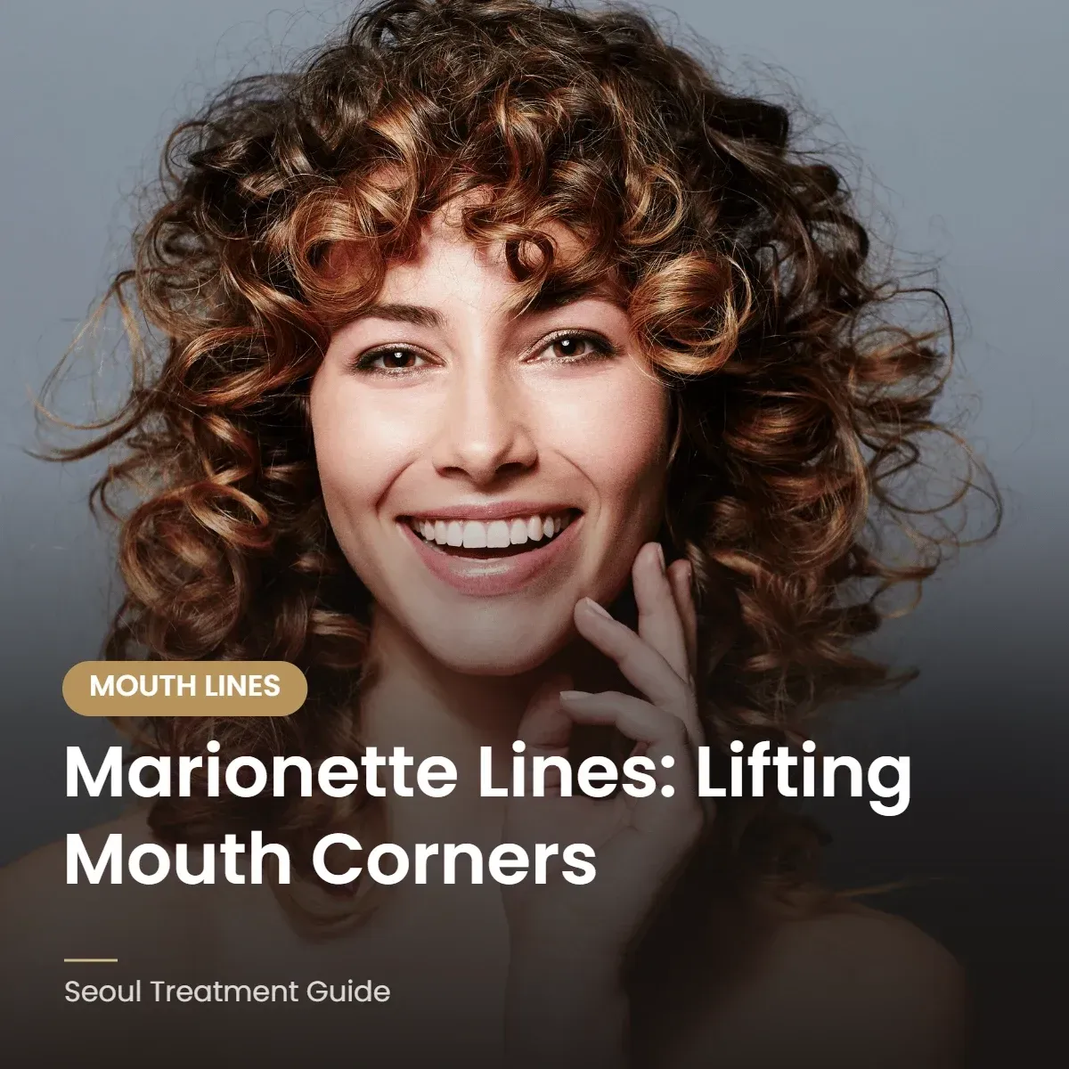 Marionette lines treatment options