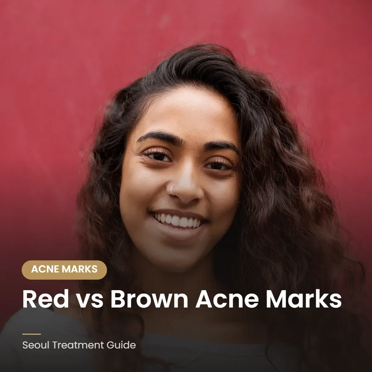 Red and brown acne marks treatment