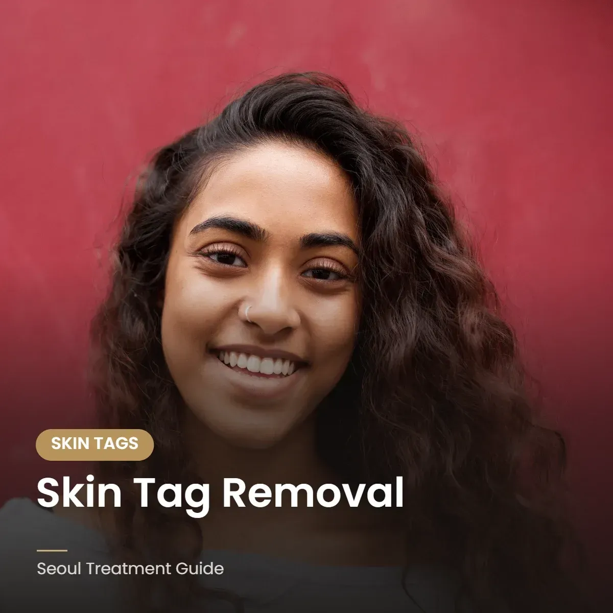 Skin tag removal on the neck