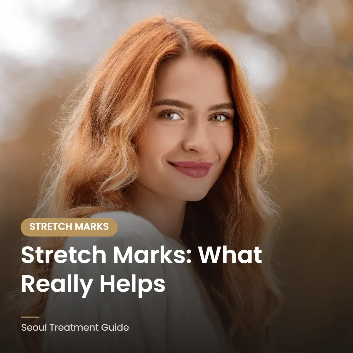 Stretch marks treatment options