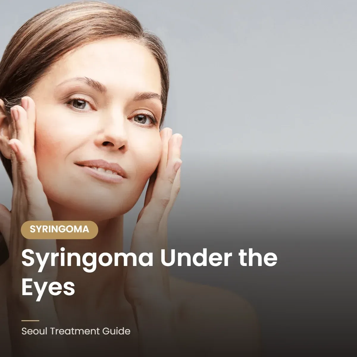 Syringoma removal under the eyes