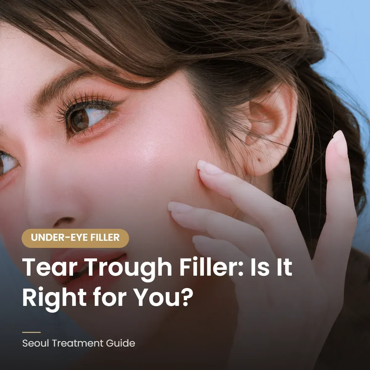 Tear trough under-eye filler guide