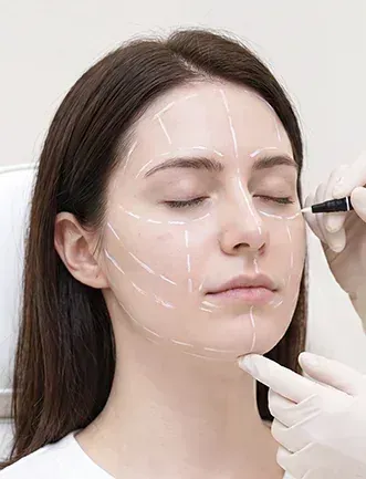 Thread treatment on the face