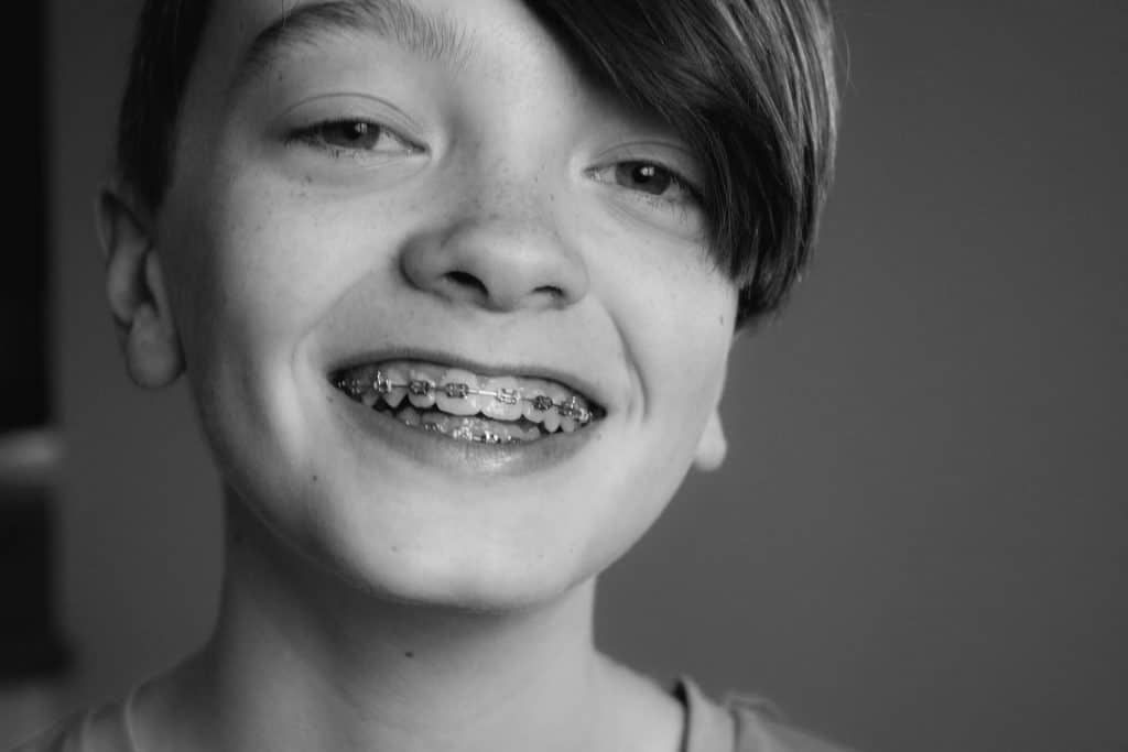 Boy with braces smiling, close-up shot, black and white photo.