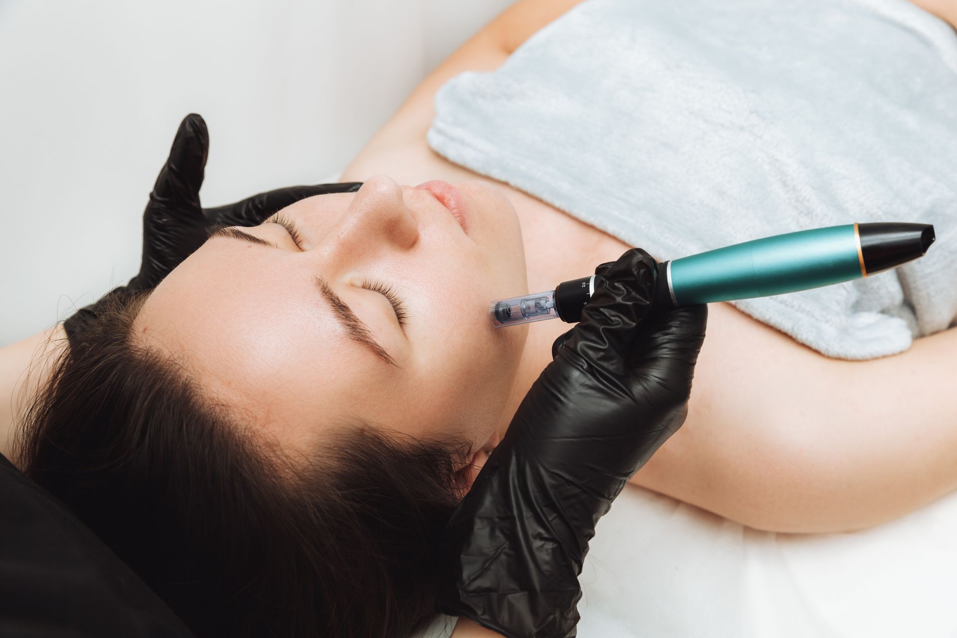 Woman receiving microneedling treatment on her face. A gloved hand uses a pen-like device on her cheek.