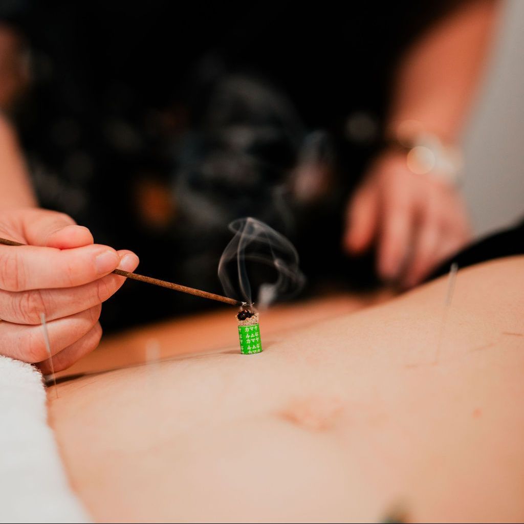 Hand holding a burning incense stick near a green acupuncture needle on skin