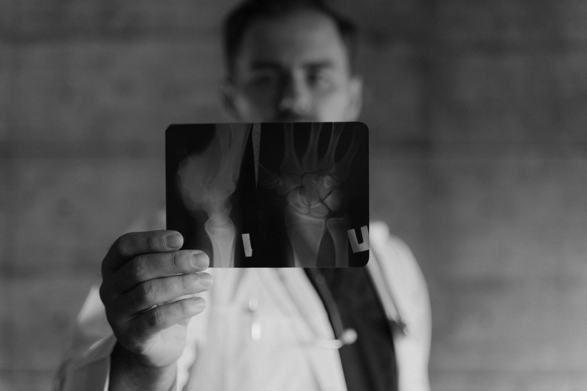 Doctor holding an X-ray, likely showing a hand or wrist. Black and white photo in a dim room.