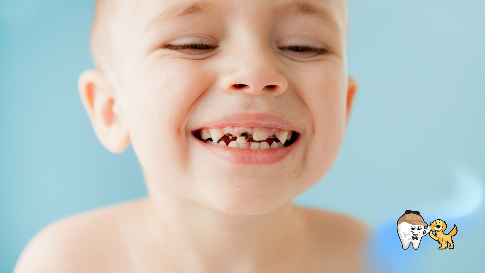 Child with decayed teeth, smiling. Blue background.
