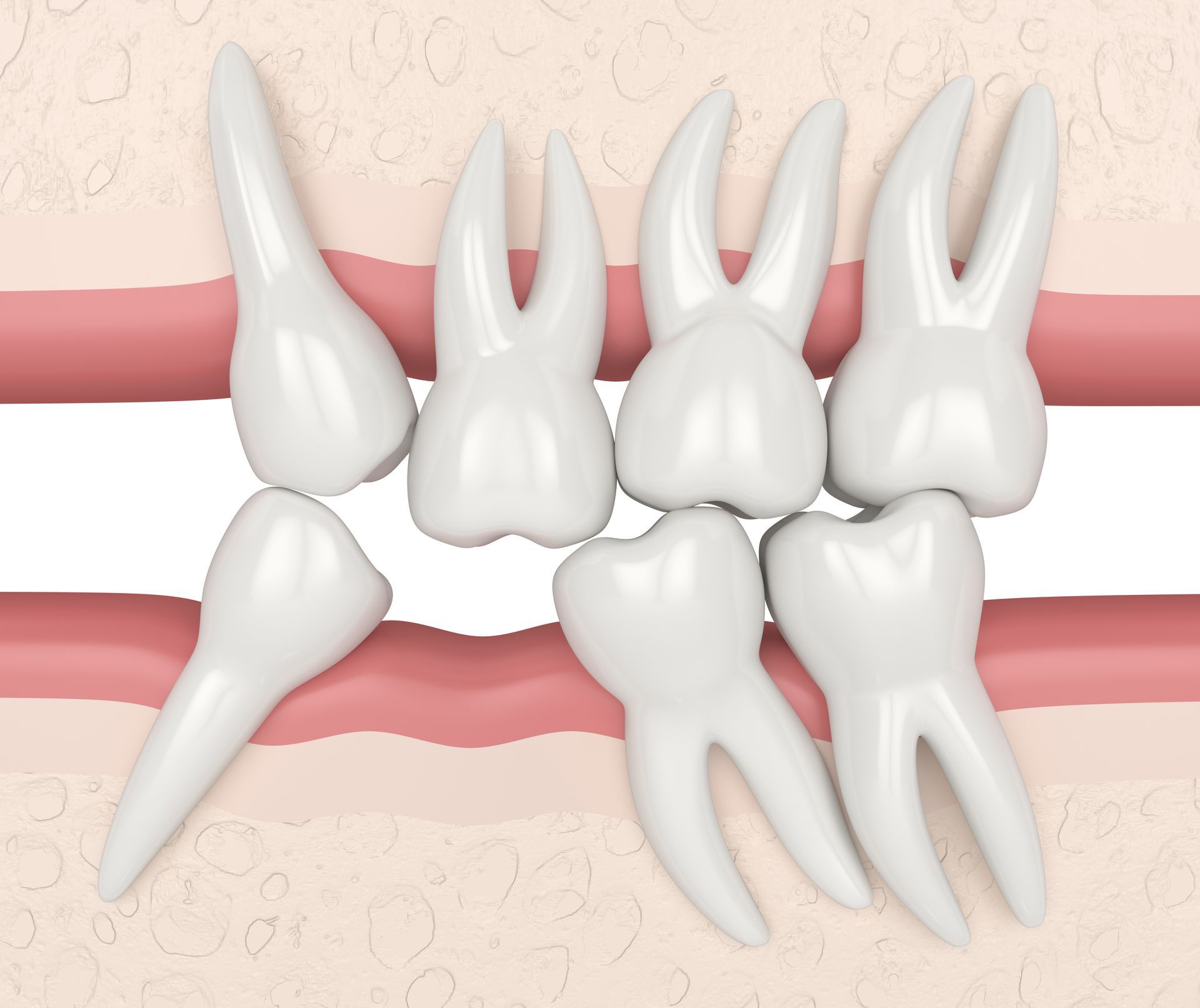 Dentist holding a dental model with teeth, roots, and an implant illustration