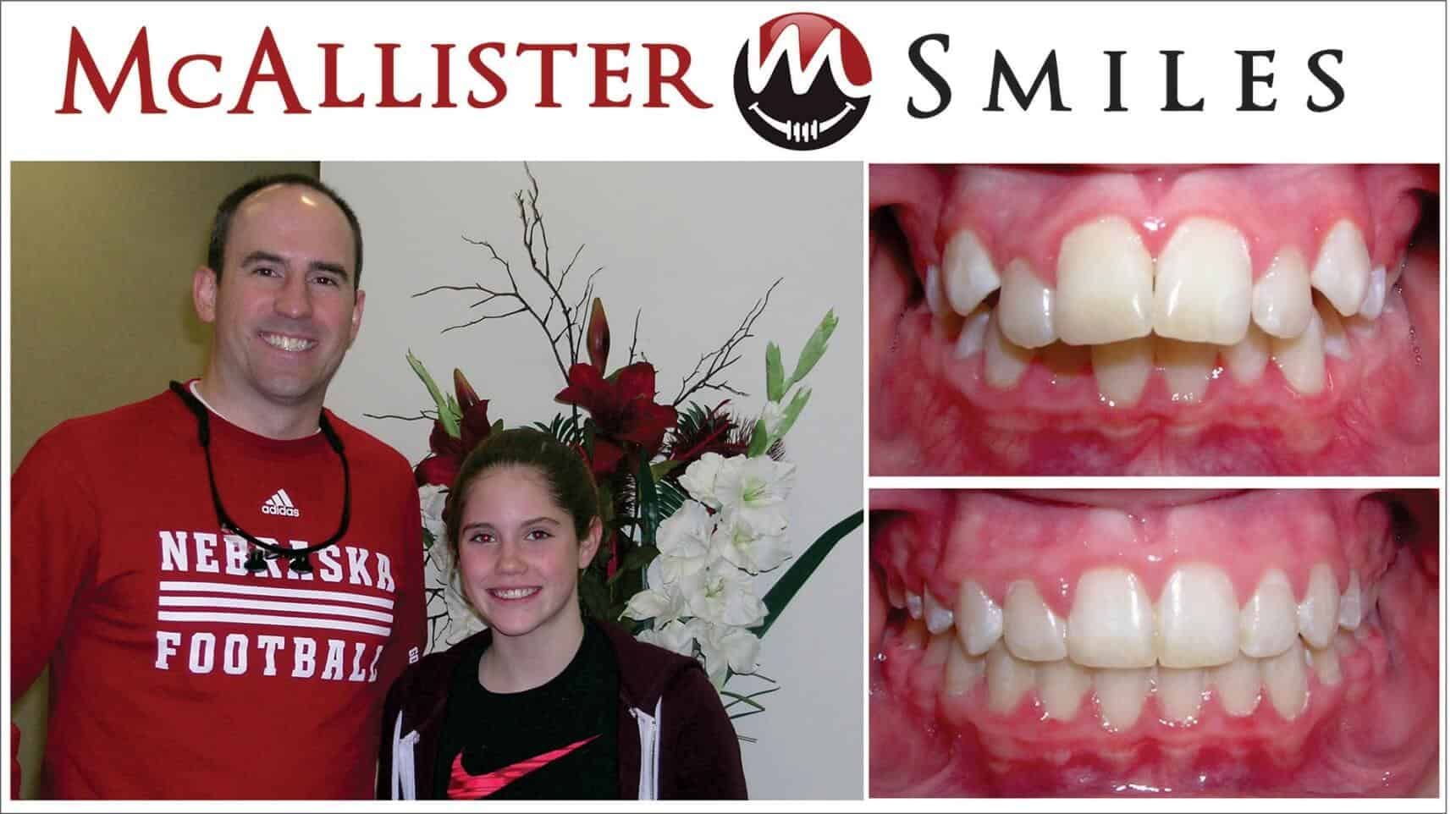 A man wearing a Nebraska football shirt stands next to a girl