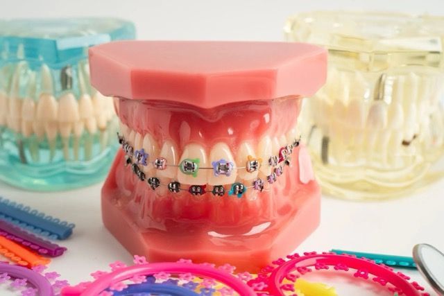colorful bands on a model of a mouth