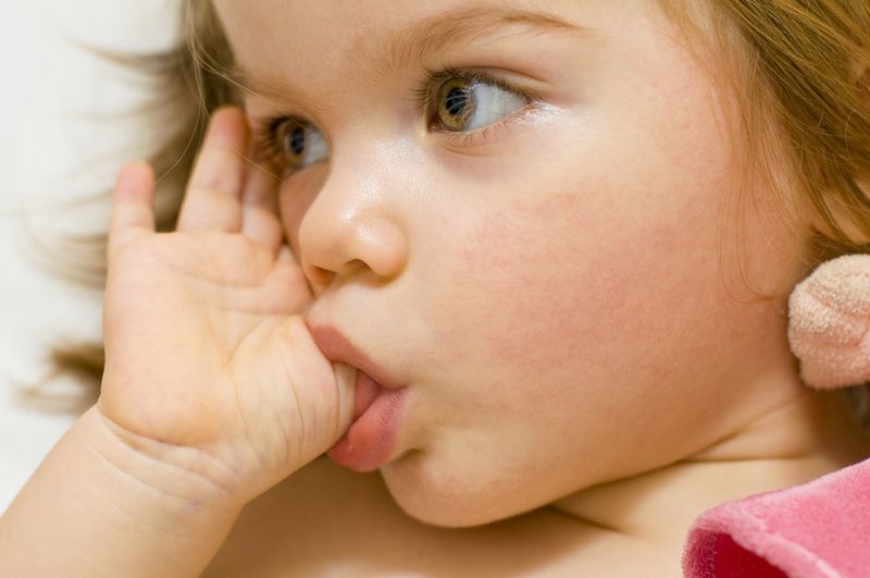 The Effects of Prolonged Thumb or Finger Sucking on Open Bites