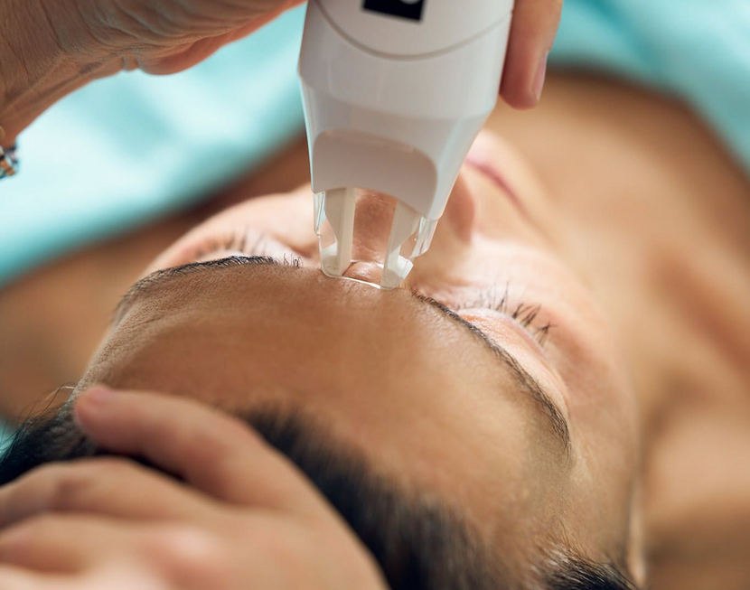 Endermologie Behandlung im Gesicht