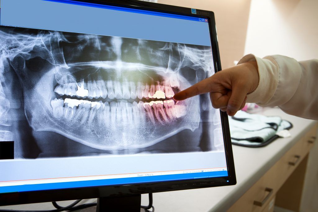 Teeth X-ray