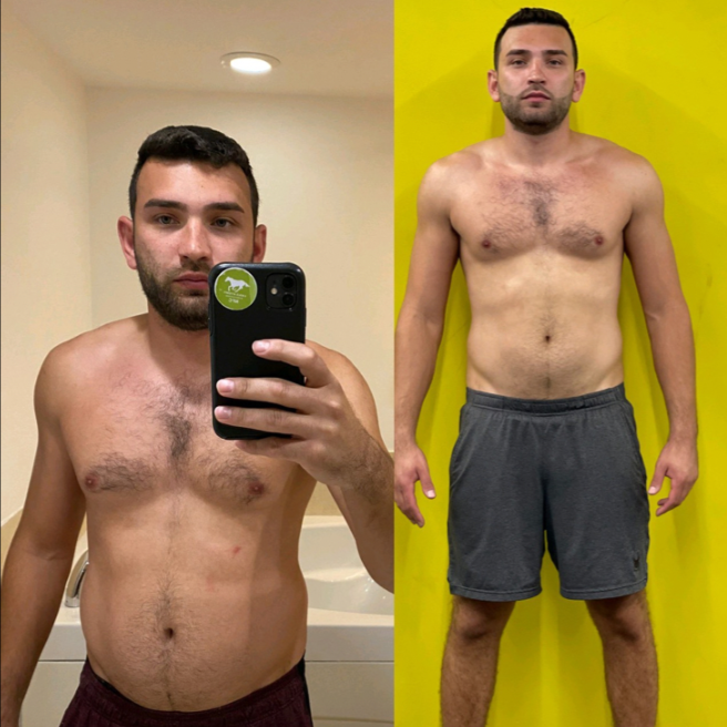  Anthony transformation