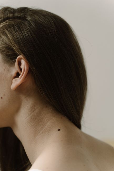 Neck liposuction