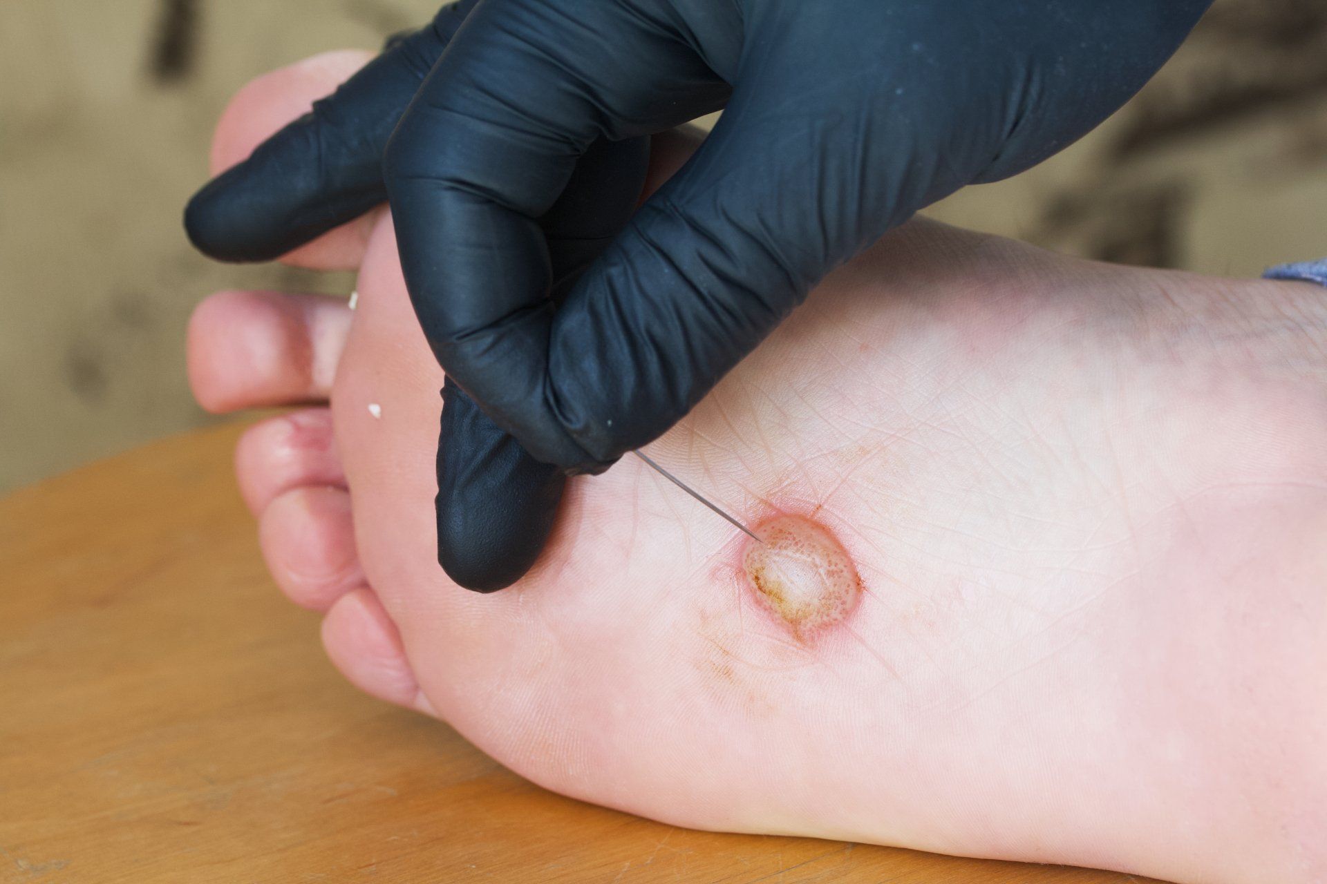 foot doctor imprinting child's footprint