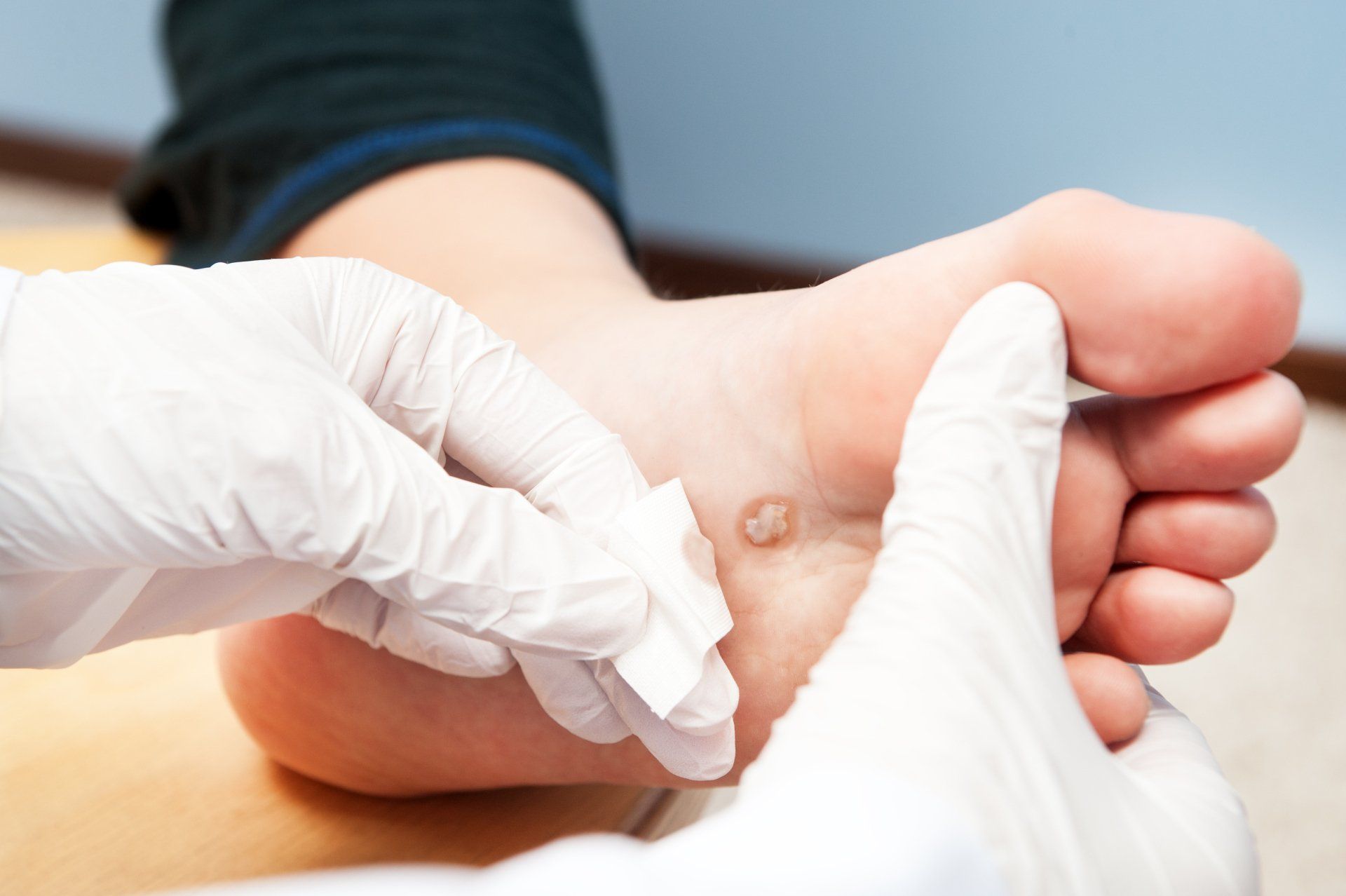foot doctor performing bunion treatment service